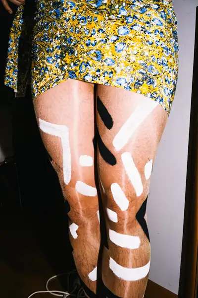 Rhinoplasty Making of