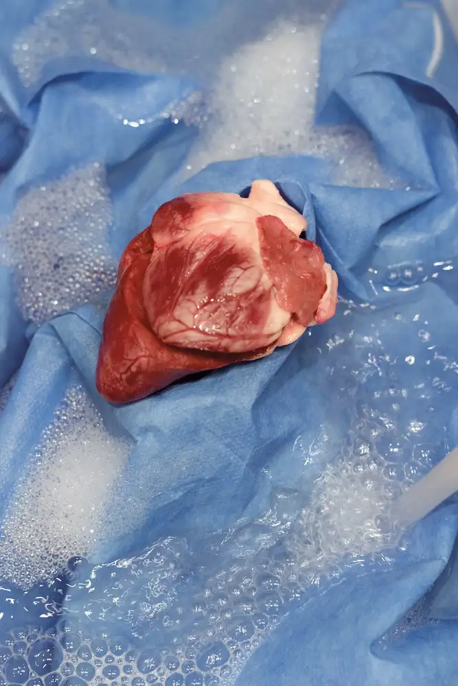 Heart - Susanna Hofer