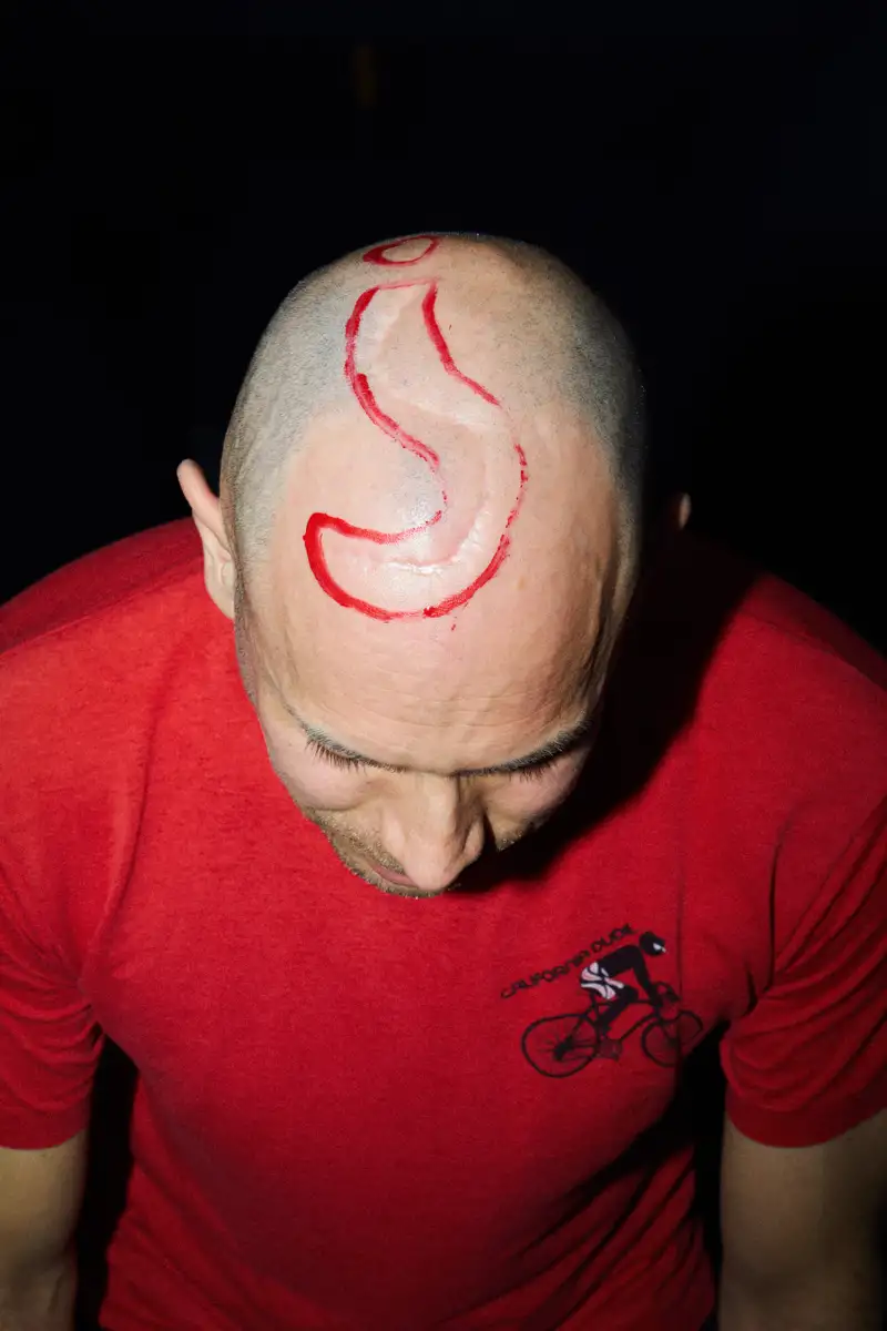 Didi Wilfling und die Fragezeichen-Narbe